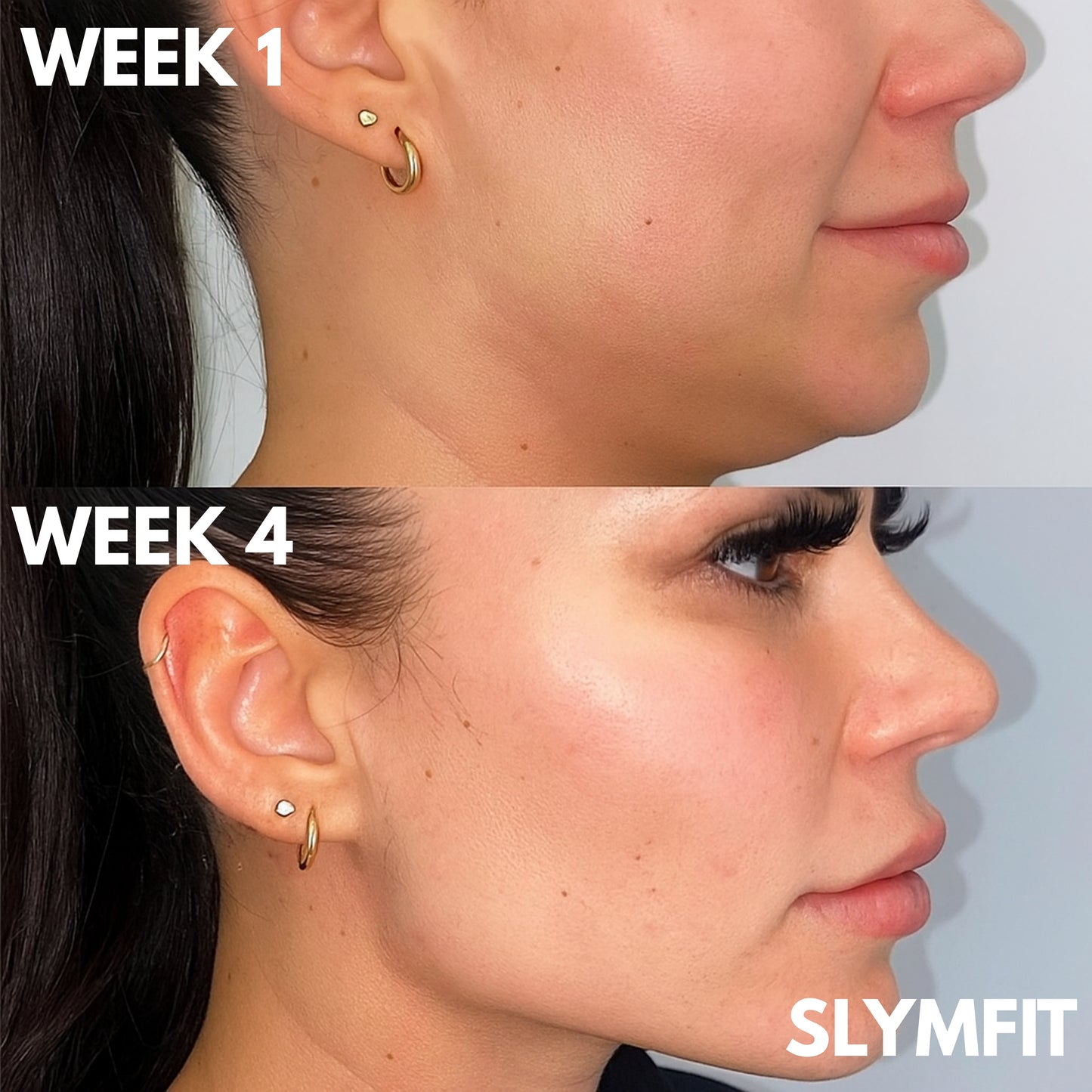 SLYMFIT | Double Chin Detox Elixir